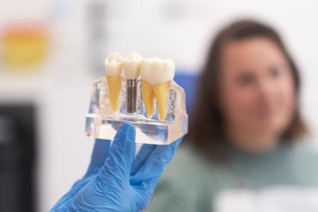 implant dentaire