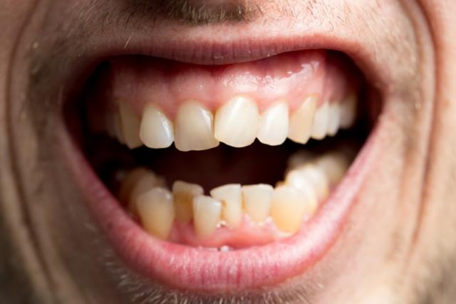 orthodontiste