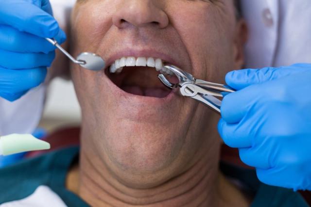 extraction dent