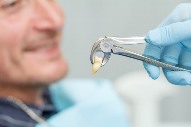 arracher une dent