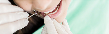 Traitement endodontique